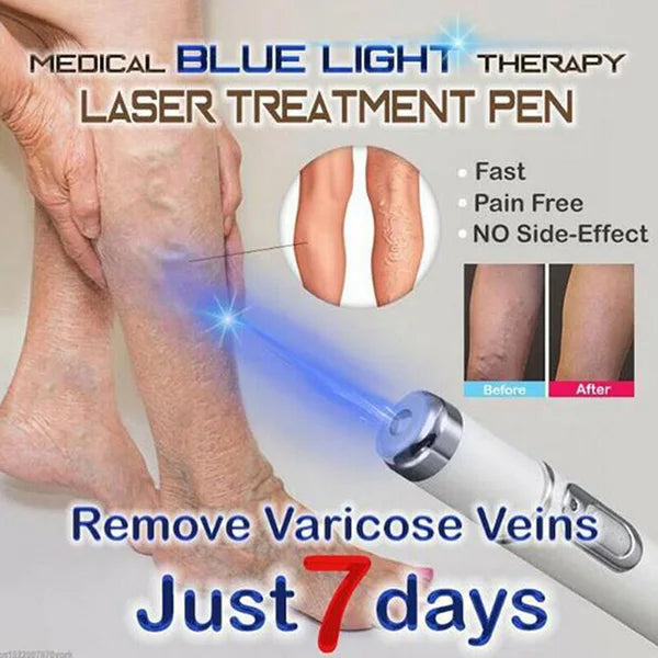 Experience the luxurious benefits of Danoz Direct Acne/Warts/Moles etc. Blue Laser Pen -