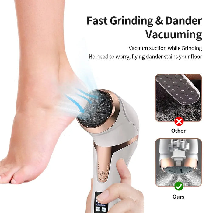 Quickly and effectively remove dead, hard skin for soft, smooth results, Say goodbye to rough, callused feet with Danoz Direct PediSpin