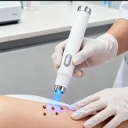 Person using a medical device on skin with text 'Only 7 days' in a clinical setting.