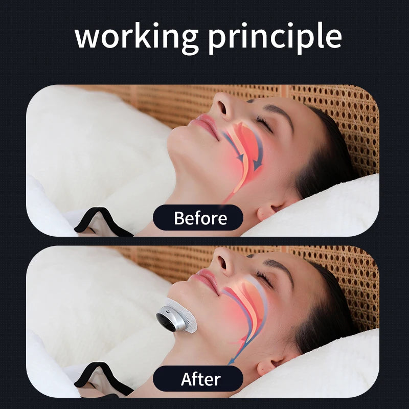 😴 Danoz SleepSmart | Anti-Snore Device | Dual-Pulse Stimulation | 3 Intensity Levels | 10hr Battery | CE Certified | Sleep Apnea Relief