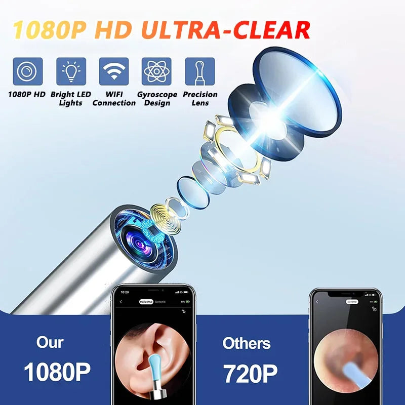 Danoz EarcareSmart - Visual Ear Wax Cleaner with Camera Safe Earwax Removal Endoscope with 5M Camera Luminous Otoscope Ear Cleaning Tools Ear Care - Buy 1 Get 1 Free!