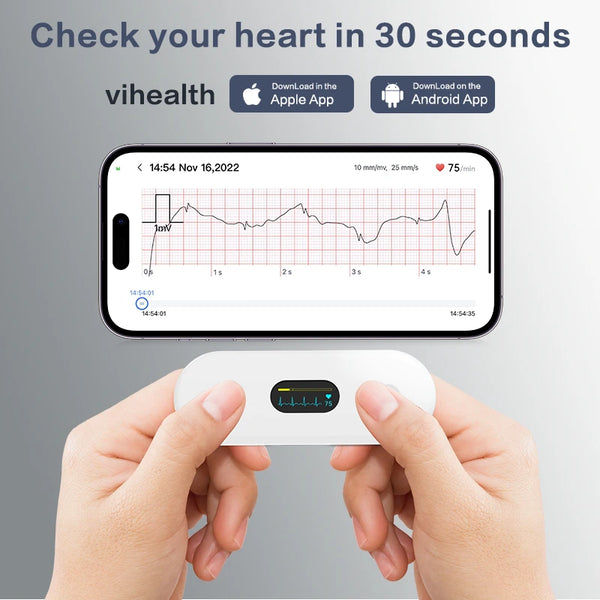 ECG monitore