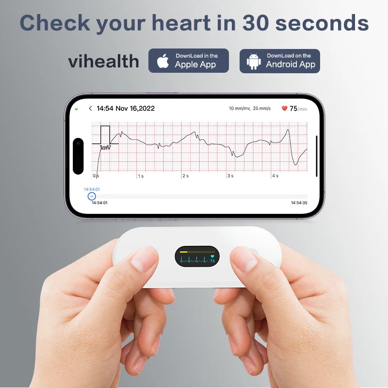 ECG monitore