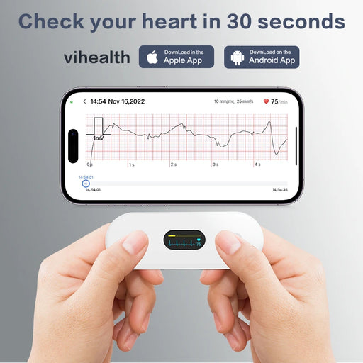 ECG monitore