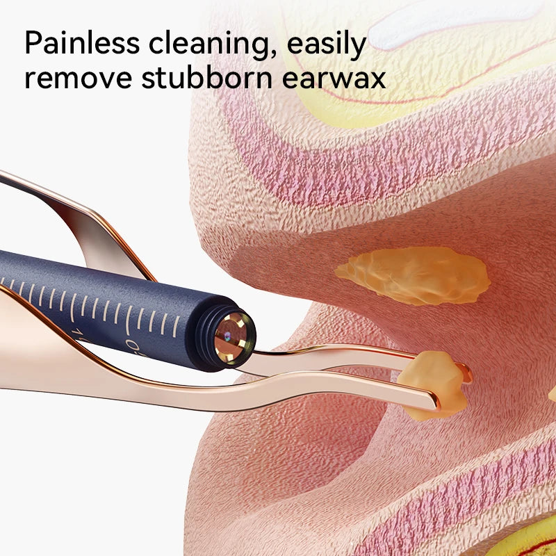 Danoz EarcareSmart - Super Bundle! Upgraded Smart Visual Ear Wax Cleaner With Camera 800W HD Endoscope Multi-Functional Visual Ear Cleaning Tool Includes Storage