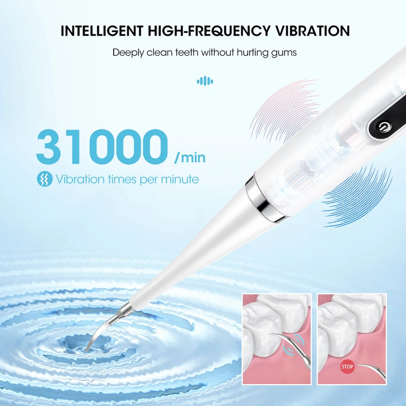 Danoz DentalSmart - USB Rechargeable - Teeth Whitening Dental Calculus Scaler Plaque Coffee Stain Tartar Removal High Frequency Sonic Toothbrush Teeth Cleaner
