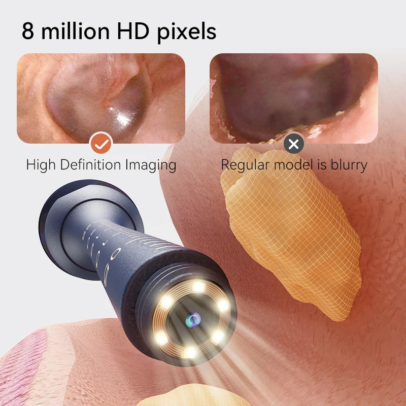 Danoz EarcareSmart - Super Bundle! Upgraded Smart Visual Ear Wax Cleaner With Camera 800W HD Endoscope Multi-Functional Visual Ear Cleaning Tool Includes Storage