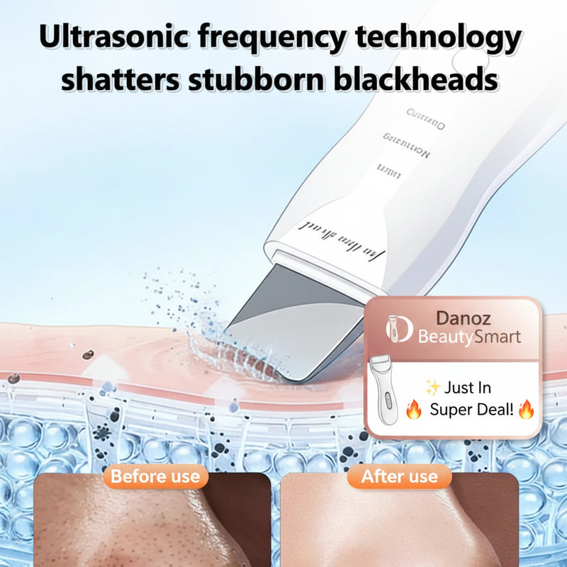 Ultrasonic device for blackhead removal with before and after effects on skin.