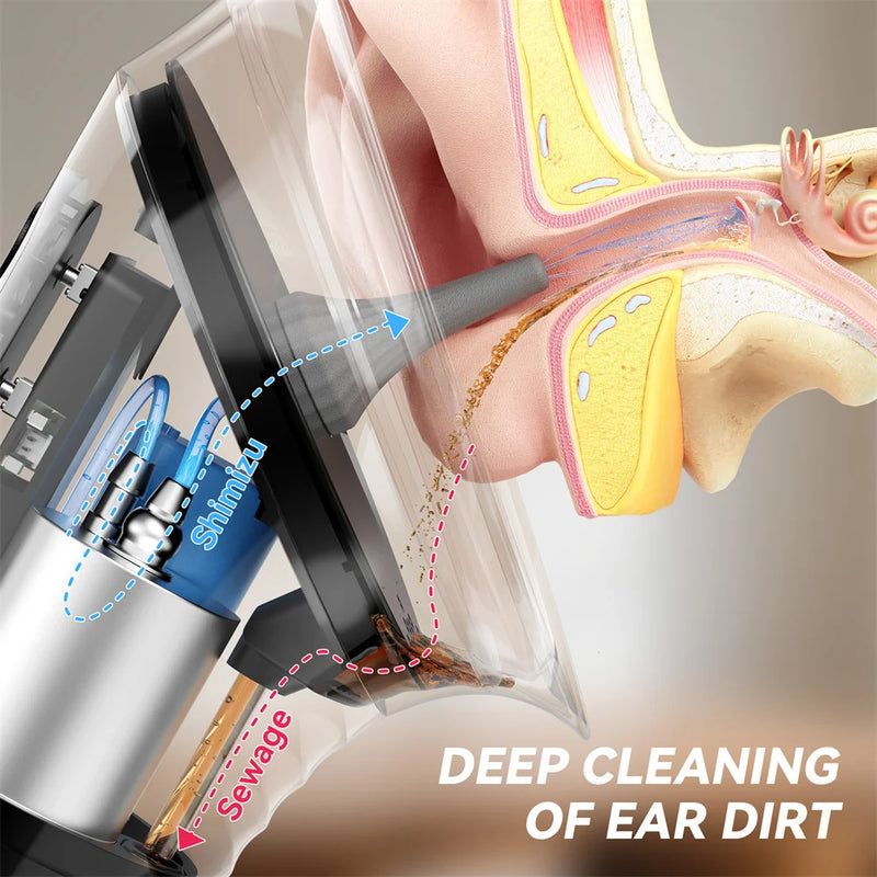 👂 Danoz EarSmart | SUNUO Electric Ear Wax Removal Kit | Dual Water Tank | 3 Pressure Modes | LED Display | Type-C Rechargeable