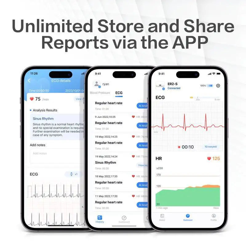 ❤️ Danoz HealthSmart | LEPU Medical ER2 Portable ECG Monitor | Instant Heart Health Check | AI-ECG Analysis | Bluetooth | Arrhythmia Screening ✨