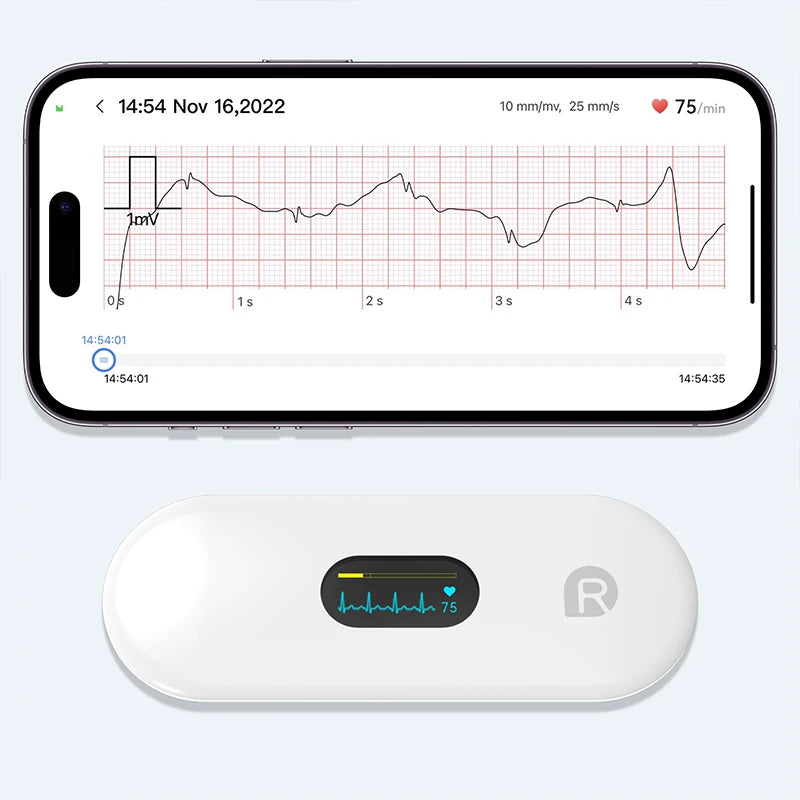 ❤️ Danoz HealthSmart | LEPU Medical ER2 Portable ECG Monitor | Instant Heart Health Check | AI-ECG Analysis | Bluetooth | Arrhythmia Screening ✨