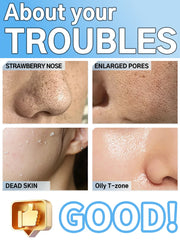 Skincare issues with labeled areas and a 'Good!' thumbs-up icon.