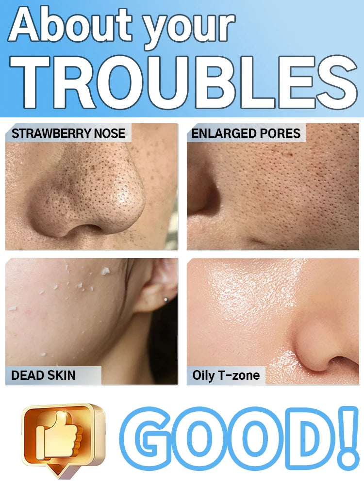 Skincare issues with labeled areas and a 'Good!' thumbs-up icon.