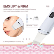 Danoz Beauty - Ultrasonic Skin Scrubber Peeling Blackhead Remover Deep Face Cleaning Ultrasonic Ion Acne Pore Cleaner Facial Shovel Scrubber - danozdirect