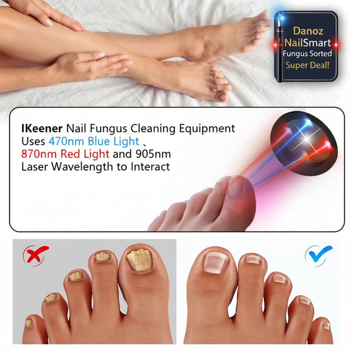 Danoz Health - Just In, Nail Fungus Laser Device Toenail Laser Therapy Machine Anti Fungal Laser USB Charge - danozdirect
