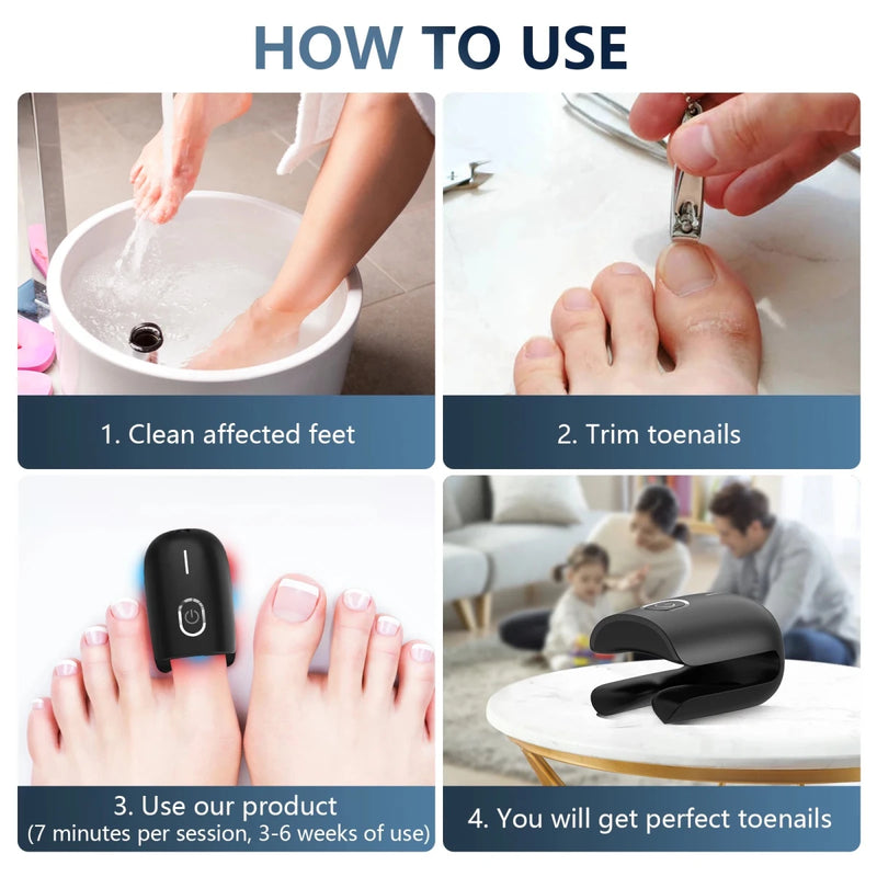 Danoz Health - Just In, Nail Fungus Laser Device Toenail Laser Therapy Machine Anti Fungal Laser USB Charge - danozdirect